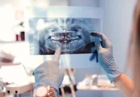 Dentists looking at x-ray image of teeth