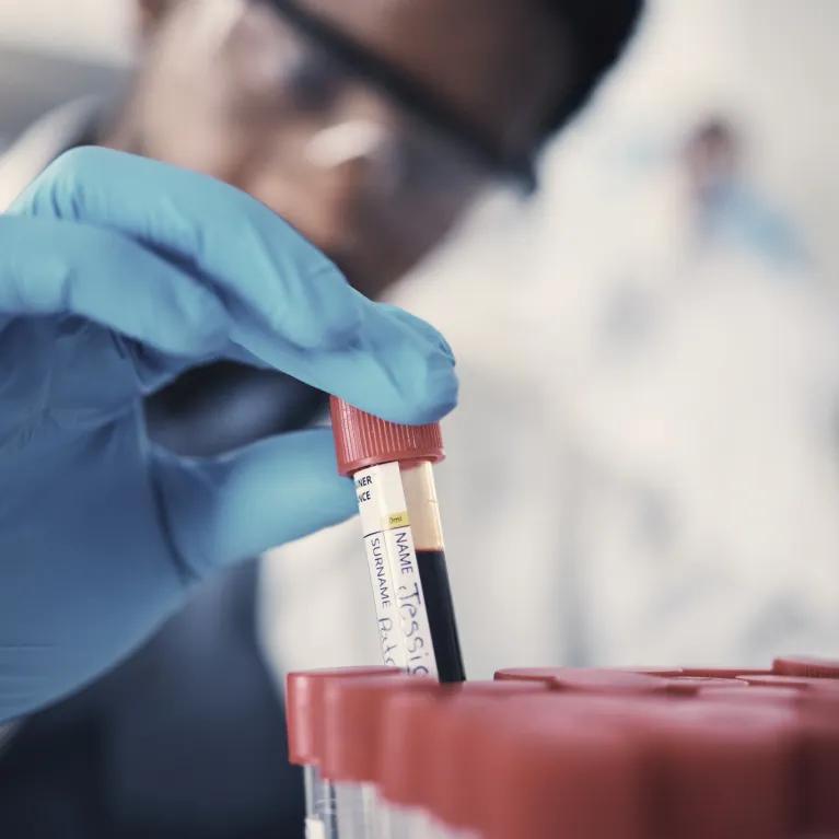Scientist preparing biological samples