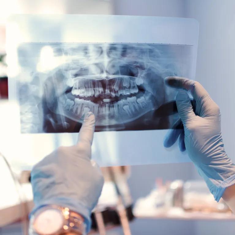 Dentists looking at x-ray image of teeth