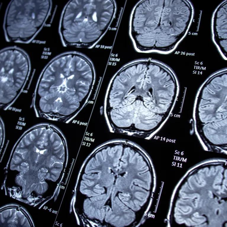 Multiple brain scan images